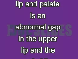 Cleft lip and palate  Cleft lip and palate information Cleft lip and palate A cleft lip