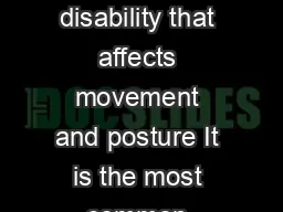 Cerebral palsy is a physical disability that affects movement and posture It is the most
