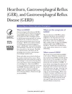 Heartburn Gastroesophageal Reux GER and Gastroesophageal Reux Disease GERD National Digestive