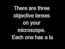 There are three objective lenses on your microscope. Each one has a la