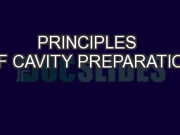 PRINCIPLES OF CAVITY PREPARATION