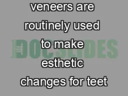 Porcelain veneers are routinely used to make esthetic changes for teet