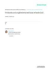 Urticaria and Angioedema without wheals  Marcus Maurer, Clive EH Gratt