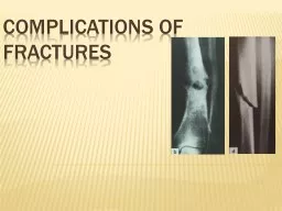 COMPLICATIONS OF FRACTURES