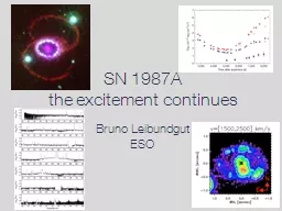 SN 1987A