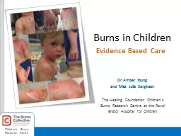 Burns in Children