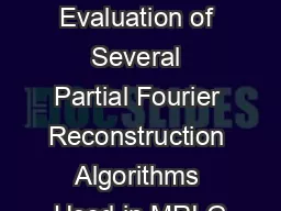 Quantitative Evaluation of Several Partial Fourier Reconstruction Algorithms Used in MRI