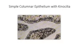 Simple Columnar Epithelium with