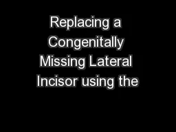 Replacing a Congenitally Missing Lateral Incisor using the