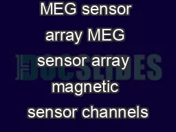 MEG sensor array MEG sensor array  magnetic sensor channels