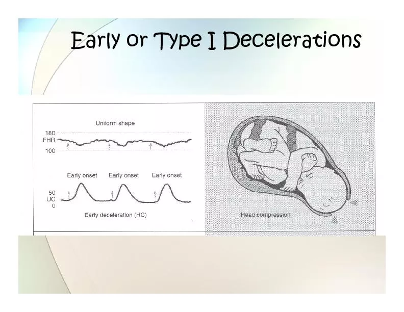 Early or Type I Decelerations