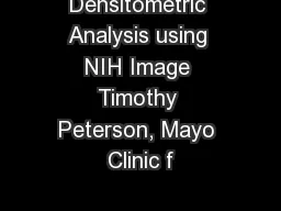 Densitometric Analysis using NIH Image Timothy Peterson, Mayo Clinic f