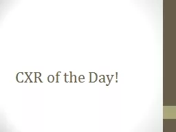 CXR of the Day!