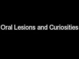 Oral Lesions and Curiosities