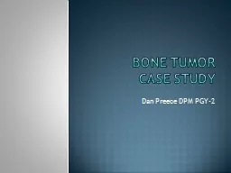 Bone Tumor