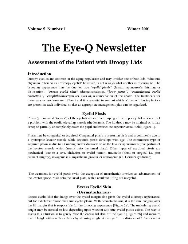 The Eye-Q Newsletter