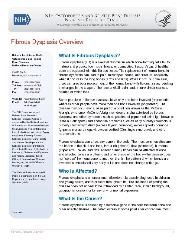 Fibrous Dysplasia Overview