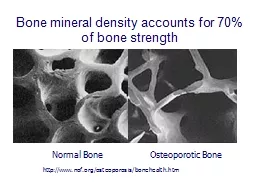 http://www.nof.org/osteoporosis/bonehealth.htm