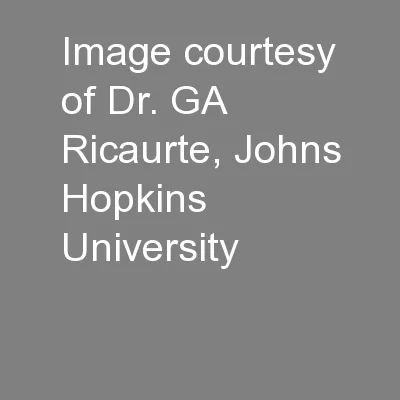 Image courtesy of Dr. GA Ricaurte, Johns Hopkins University