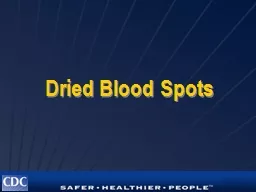 Dried Blood Spots