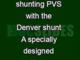 Denver ascites shunts Effectively manage refractory ascites  Peritoneovenous shunting