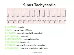 1 Sinus Tachycardia