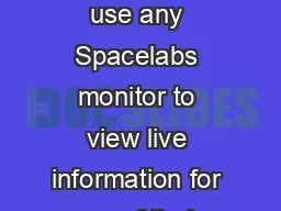 Ultraview Telemetry  With Ultraview Telemetry our nurses can use any Spacelabs monitor