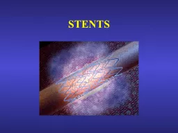 STENTS