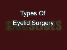 Types Of Eyelid Surgery