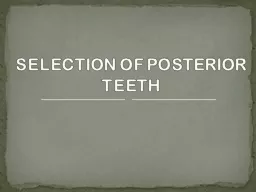 SELECTION OF POSTERIOR TEETH