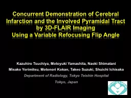 Concurrent Demonstration of Cerebral Infarction and the Inv