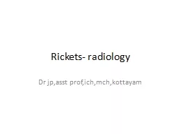 Rickets- radiology