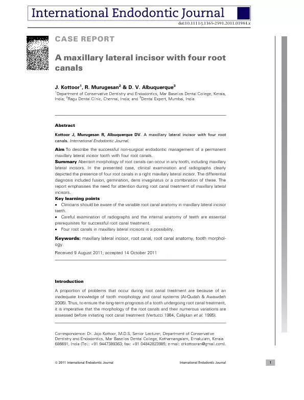Amaxillarylateralincisorwithfourroot