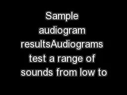 Sample audiogram resultsAudiograms test a range of sounds from low to