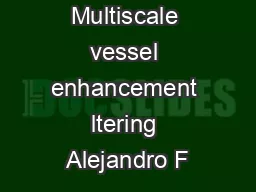 Multiscale vessel enhancement ltering Alejandro F