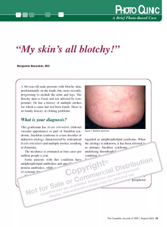 A 48-year-old male presents with blotchy skin,predominantly on the tru