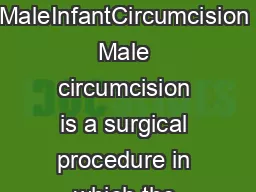 JAMA PATIENT PAGE  Circumcision MaleInfantCircumcision Male circumcision is a surgical