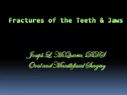 Fractures of the Teeth & Jaws