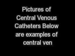 Pictures of Central Venous Catheters Below are examples of central ven