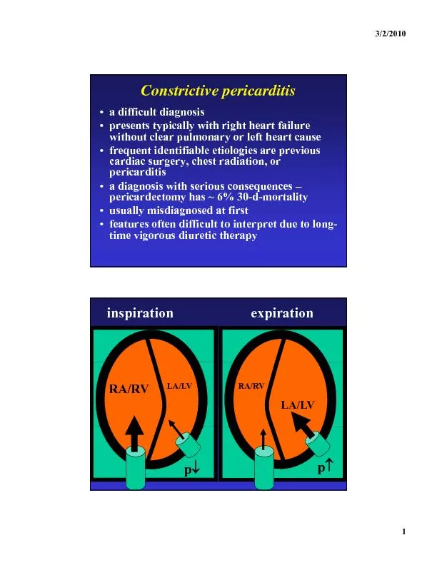 Constrictive pericarditis