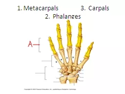 1. Metacarpals		3.  Carpals