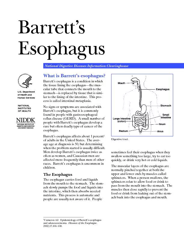 Barretts Esophagus