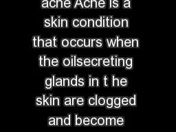Acne What is acne Acne is a skin condition that occurs when the oilsecreting glands in
