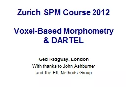 Zurich SPM Course