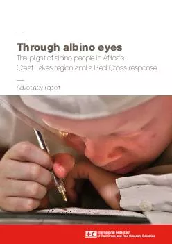 Advocacy report Through albino eyes The plight of albino people in Africas Great Lakes region and a Red Cross response   International Federation of Red Cross and Red Crescent Societies Any part of t