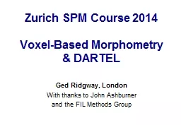 Zurich SPM Course