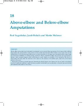 Aboveelbow and Belowelbow Amputations Paul Sugarbaker Jacob Bickels and Martin Malawer