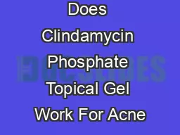 Does Clindamycin Phosphate Topical Gel Work For Acne