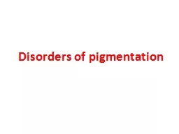 Disorders of pigmentation