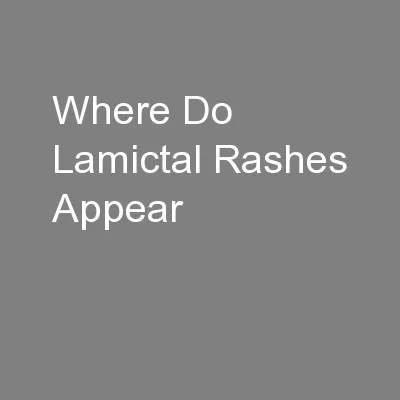 Where Do Lamictal Rashes Appear